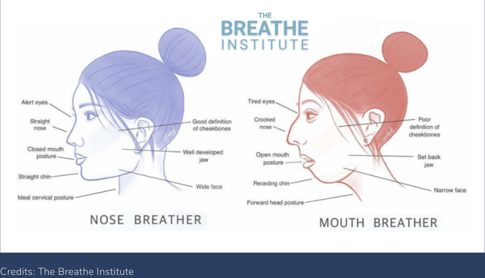 The Breathe Institute — Nose Breather vs Mouth Breather